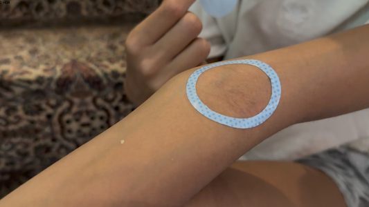 Thimble prepare patch at IV site